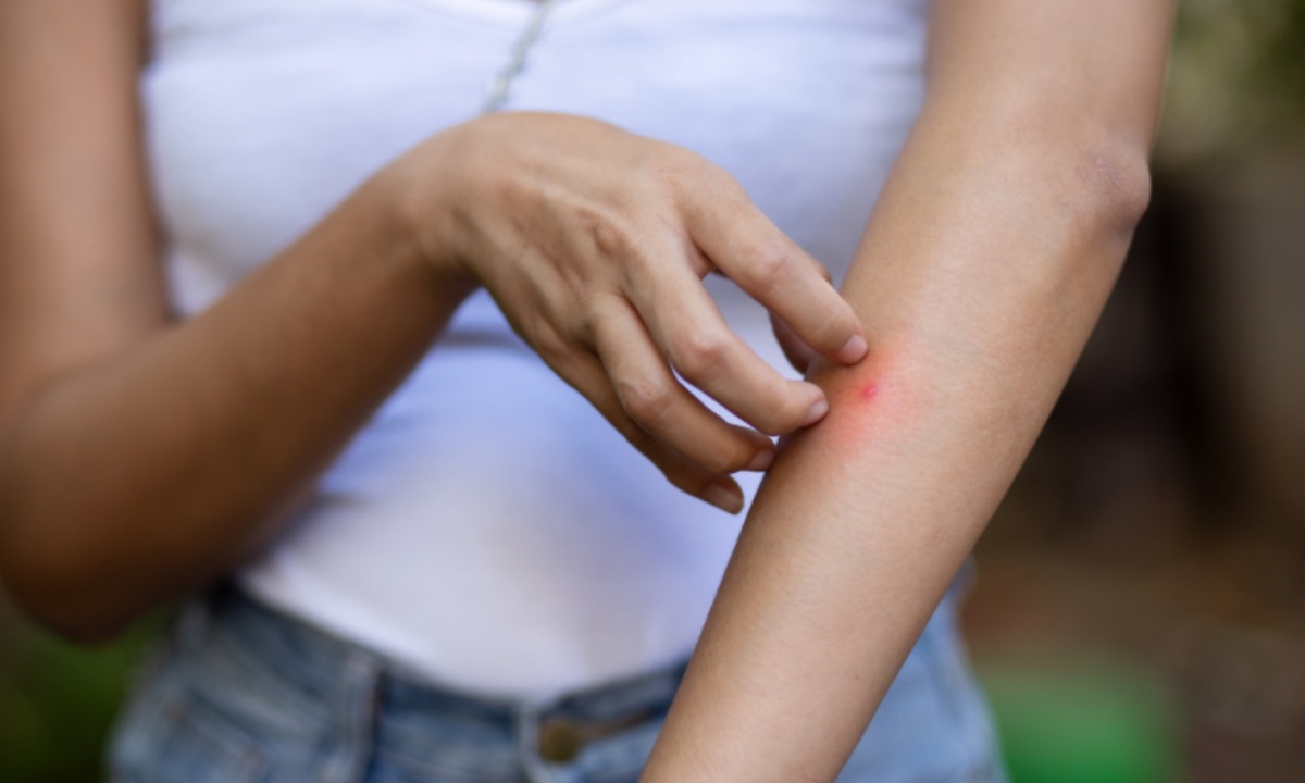 Какая аллергия самая распространенная