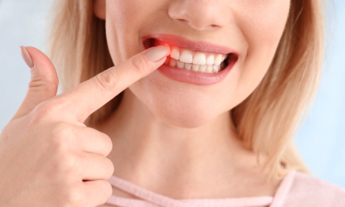 Какие привычки разрушают зубную эмаль