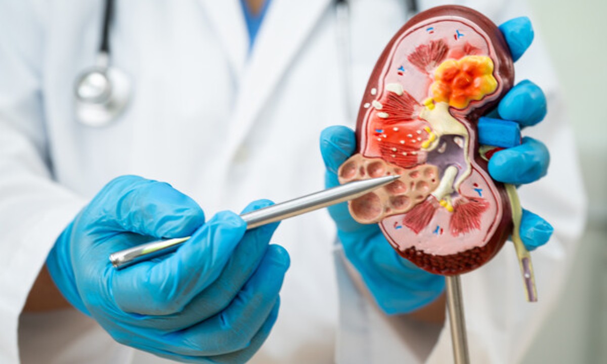 Назван неочевидный симптом проблем с почками