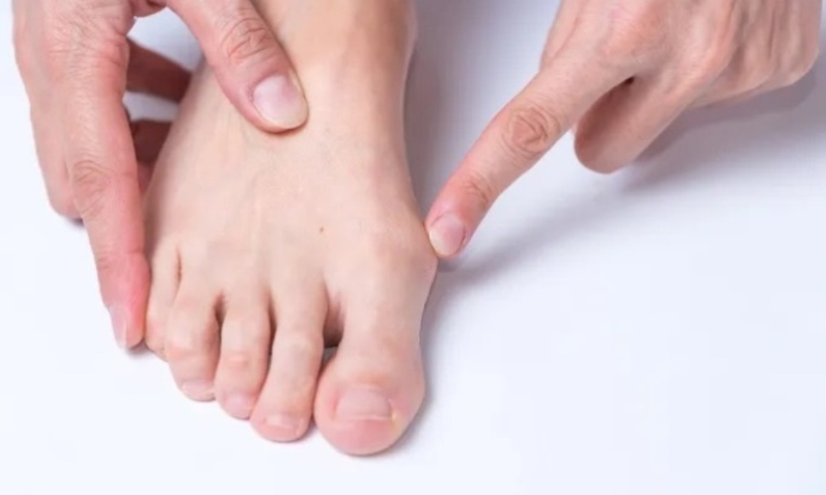 Можно ли исправить деформацию стопы без операции?