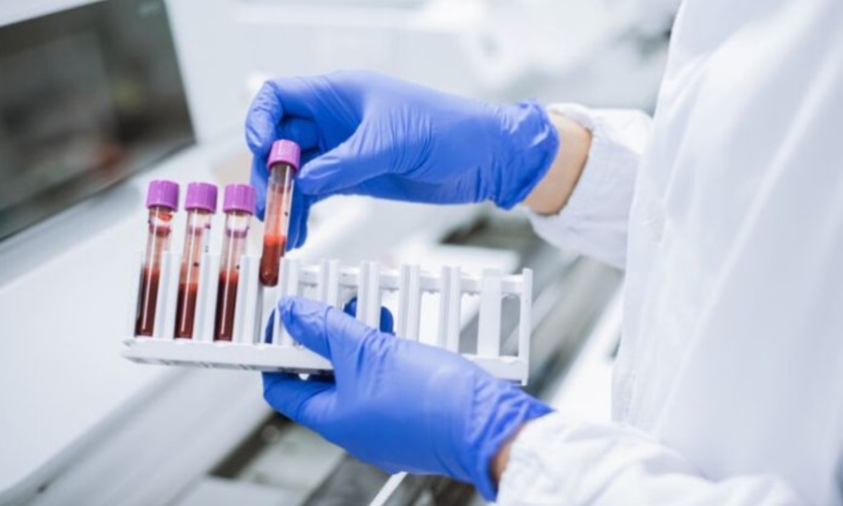 Сколько раз в год нужно сдавать анализ крови