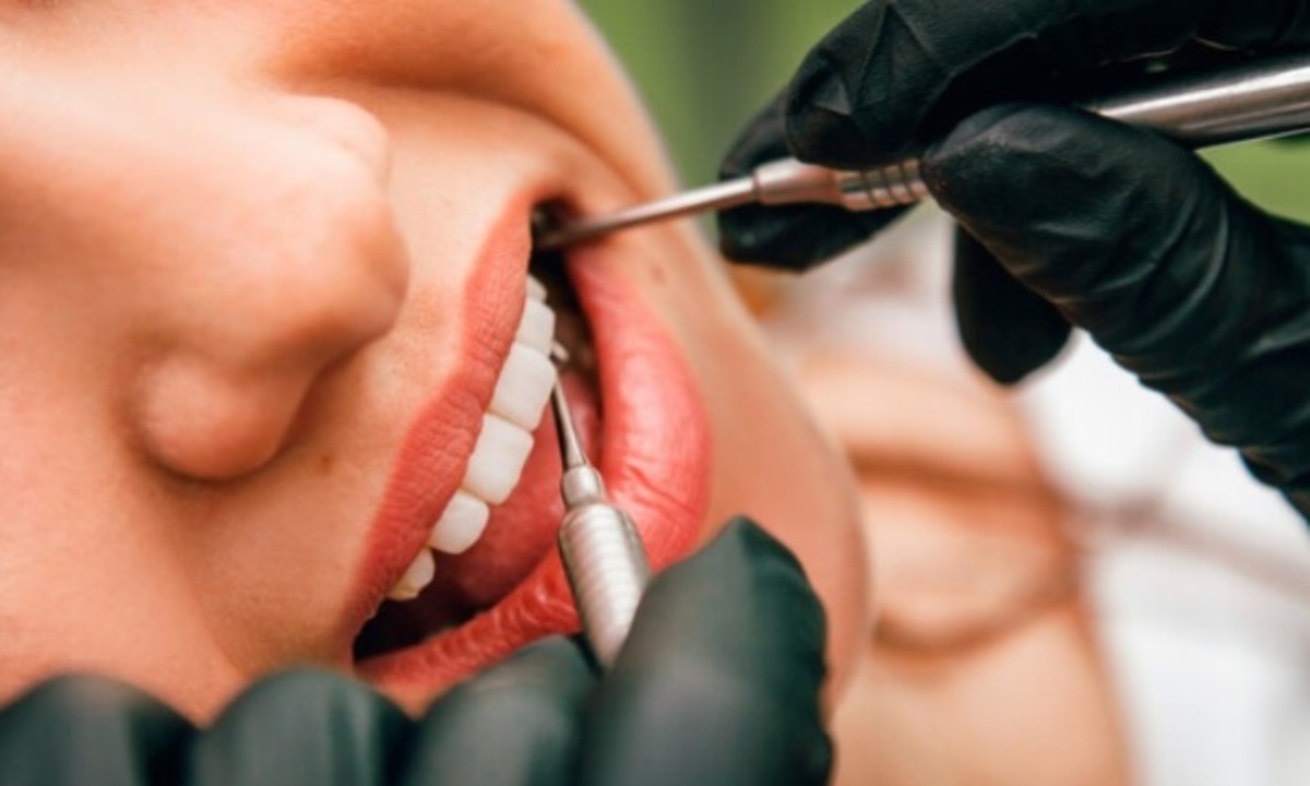 Названа необычная причина пятен на зубах