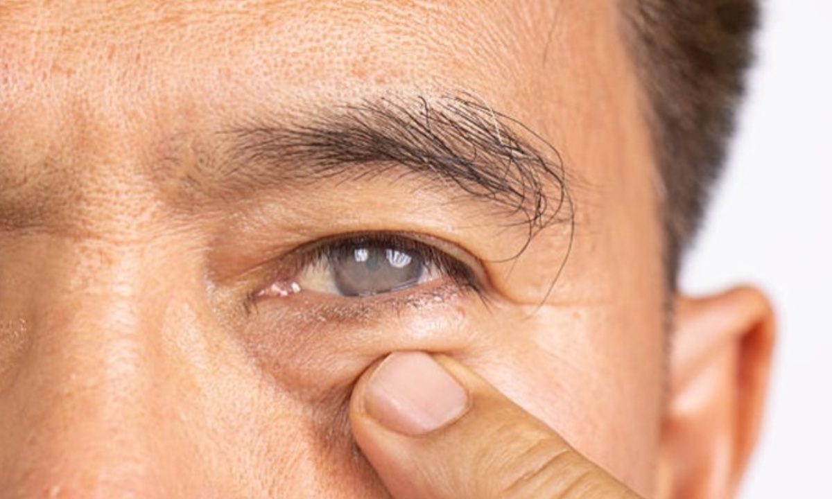 Почему гипертония может привести к развитию глаукомы