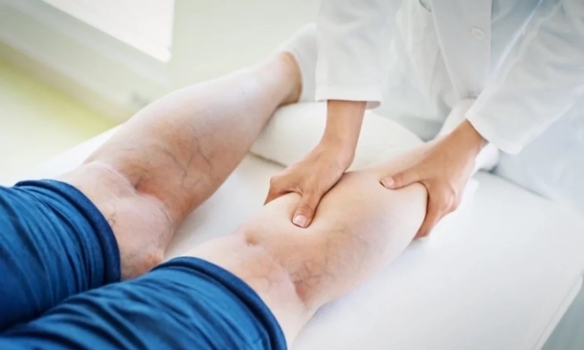 Почему сидячая работа ускоряет развитие варикоза