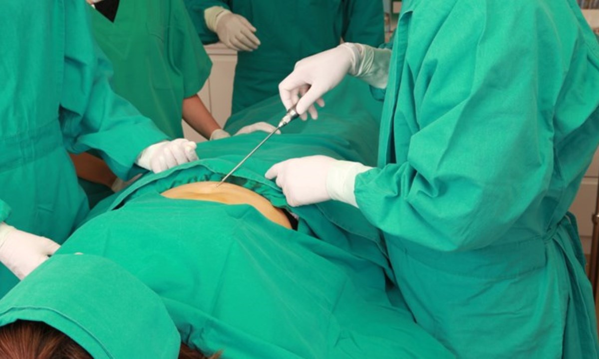 Названы опасные симптомы после липосакции, требующие срочного обращения к врачу