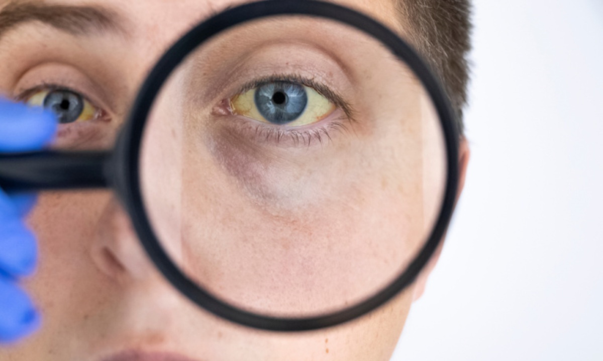 Почему нельзя употреблять алкоголь при гепатите С