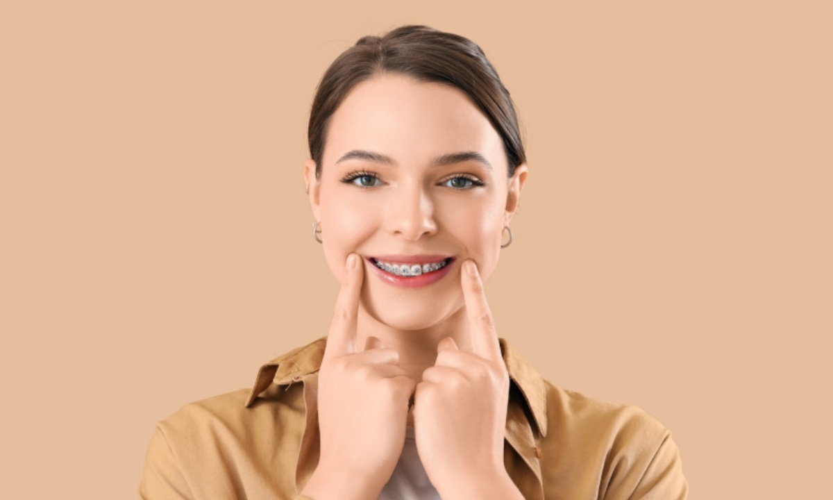 Ортодонт посоветовал устанавливать самолигирующие брекеты