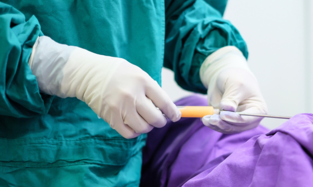 Можно ли делать липосакцию сразу нескольких зон