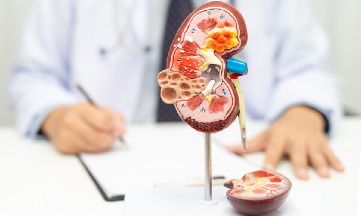 Как застой желчи может повлиять на лимфосистему почек