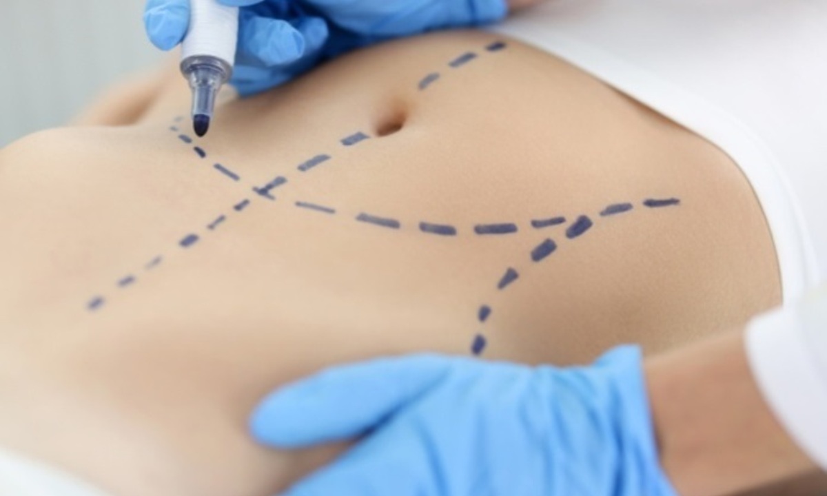 Пластический хирург оценил назвал коварные операции