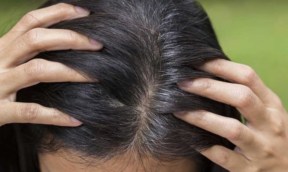 Седина не приговор — можно ли замедлить появление седых волос