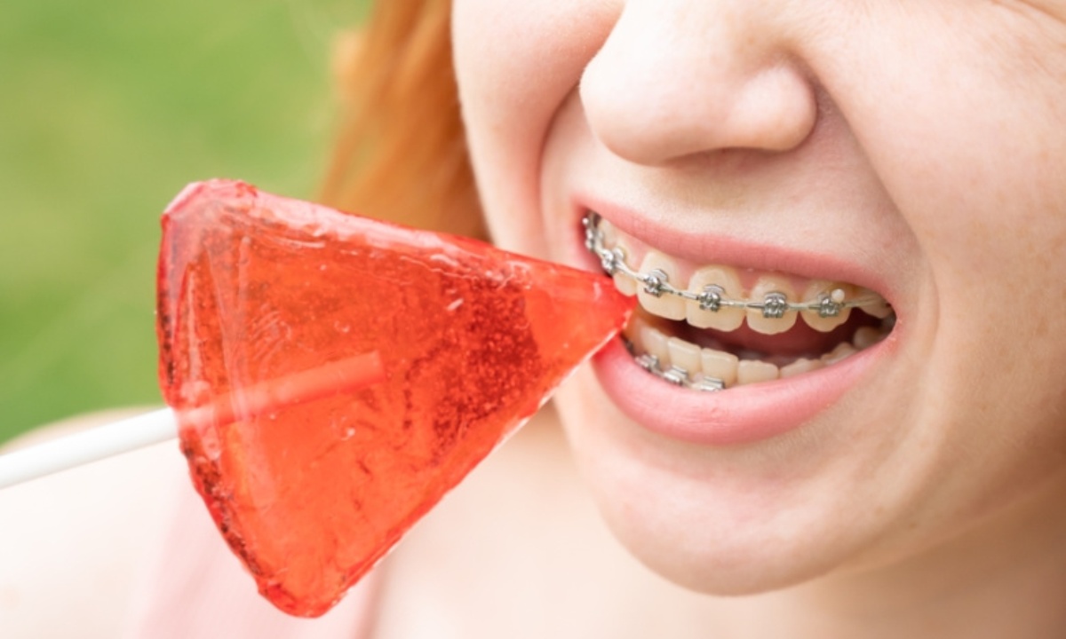 Чем может обернуться преждевременное снятие брекетов