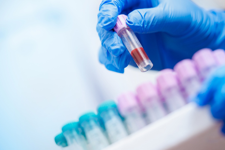 Какие анализы крови могут помочь обнаружить рак