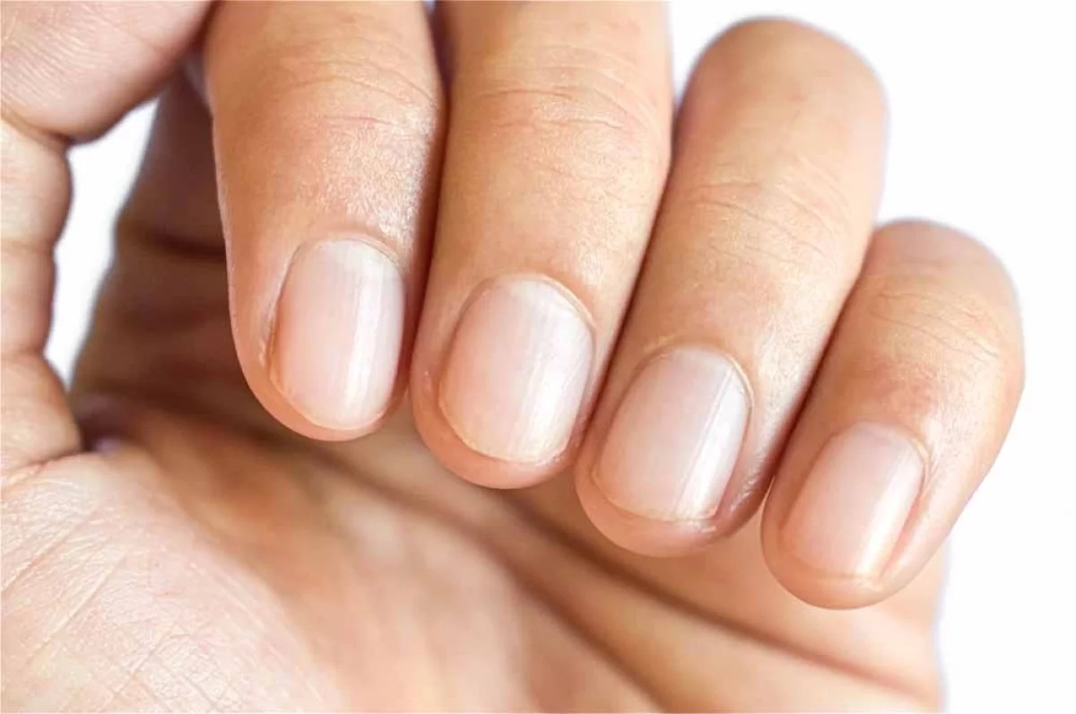 О каких болезнях говорят белые полосы на ногтях