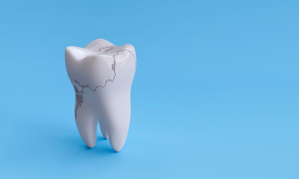 Зубы стираются незаметно — к чему это приводит и почему важно не игнорировать первые признаки