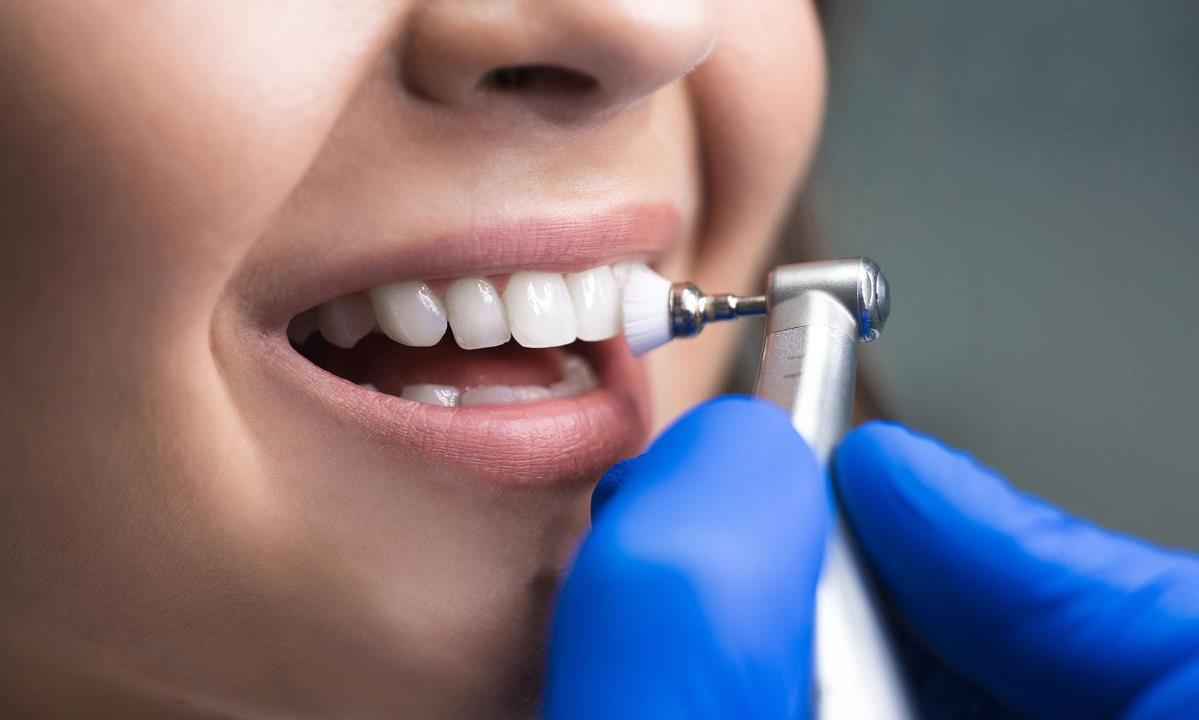 После чистки зубов есть ограничения? Что важно знать в первые часы