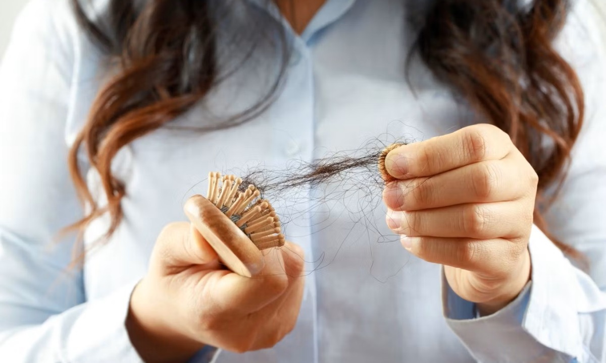 Какие анализы назначают при выпадении волос