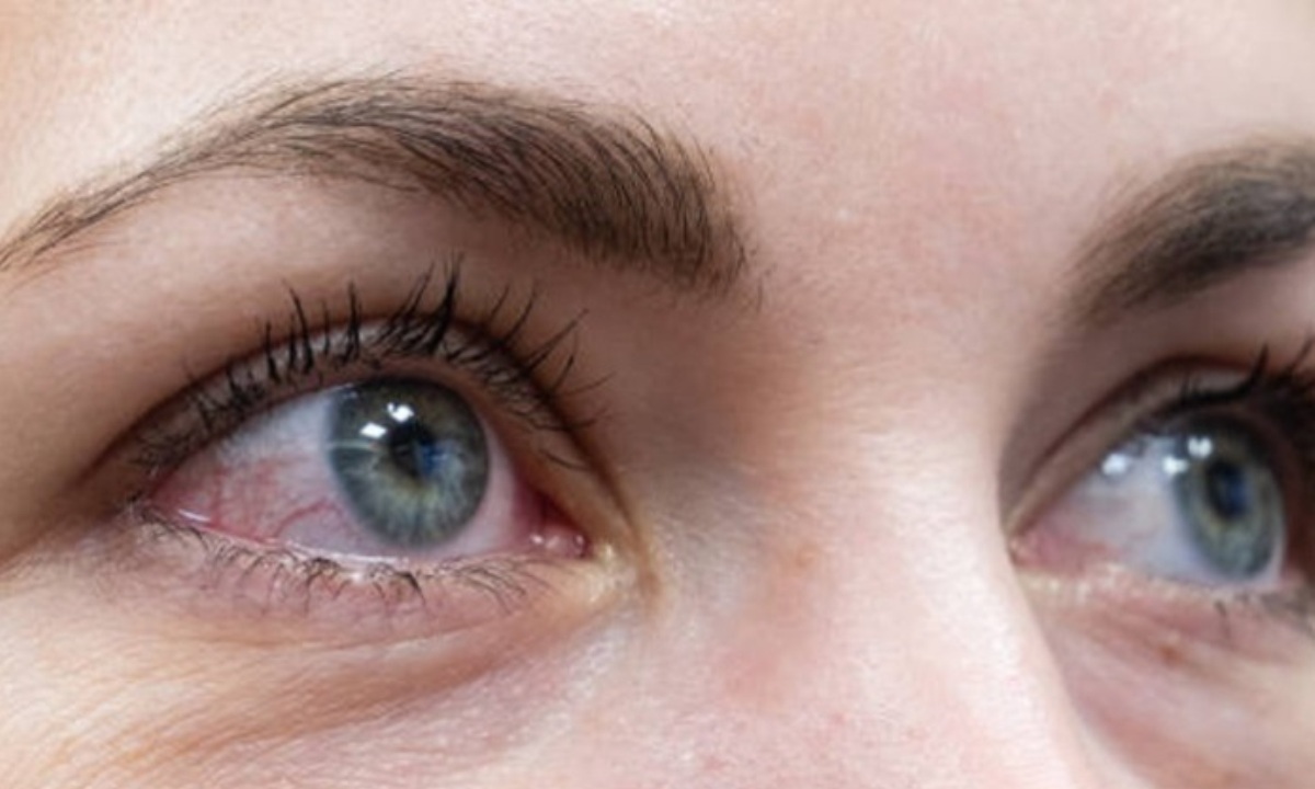 Как сохранить зрение при долгой работе за компьютером