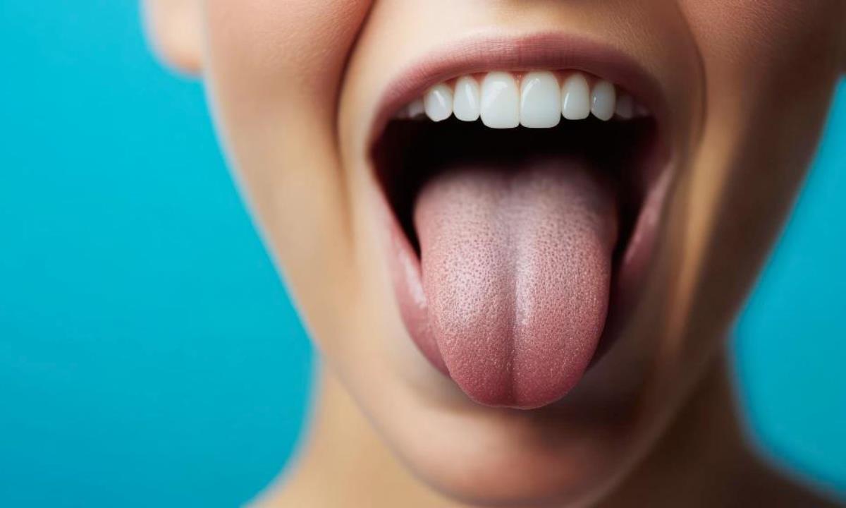 Язык подскажет о здоровье — на какие сигналы стоит обратить внимание