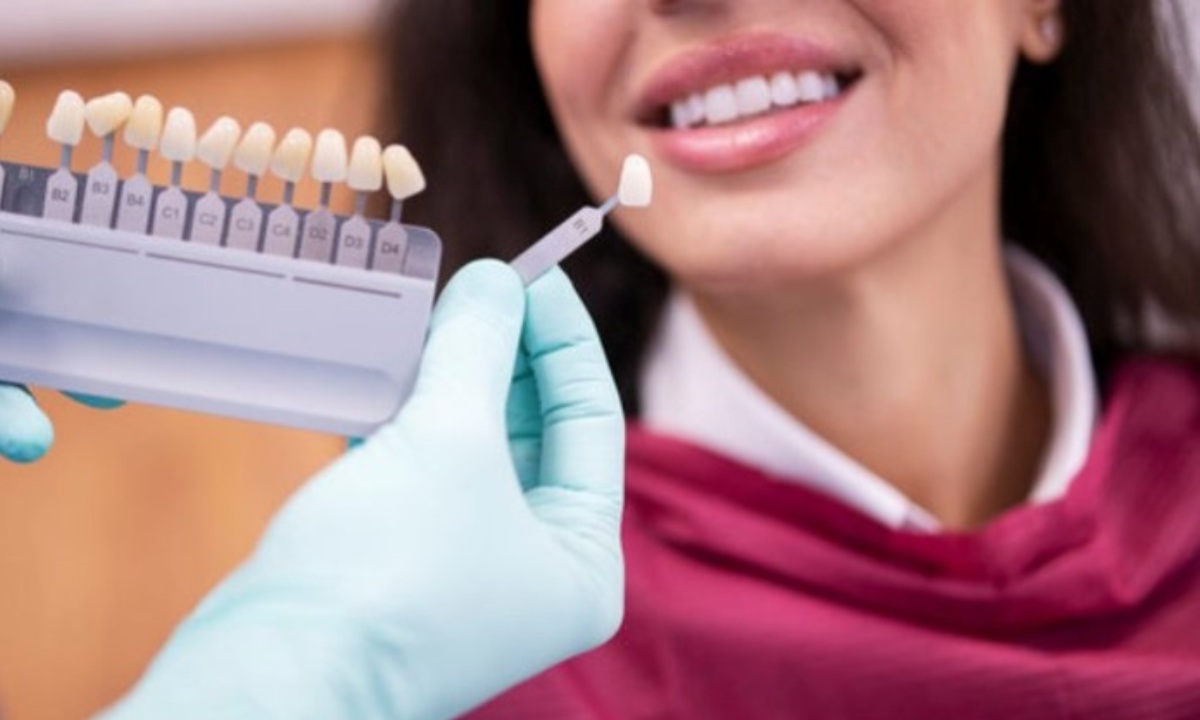 Использование виниров с маркетплейсов может вызвать аллергию